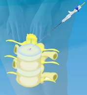 Ortho_ScanausBroschuere_01