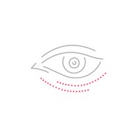 20240131_Biolitec_Lipolyse_Icon_Auge