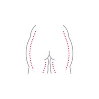 20240131_Biolitec_Lipolyse_Icon_Po