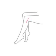 20240131_Biolitec_Lipolyse_IIcon_Knie